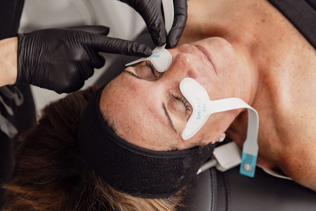 A provider's hand place Emface applicators onto a woman's cheeks for a nonsurgical facelift in St. Charles, IL.