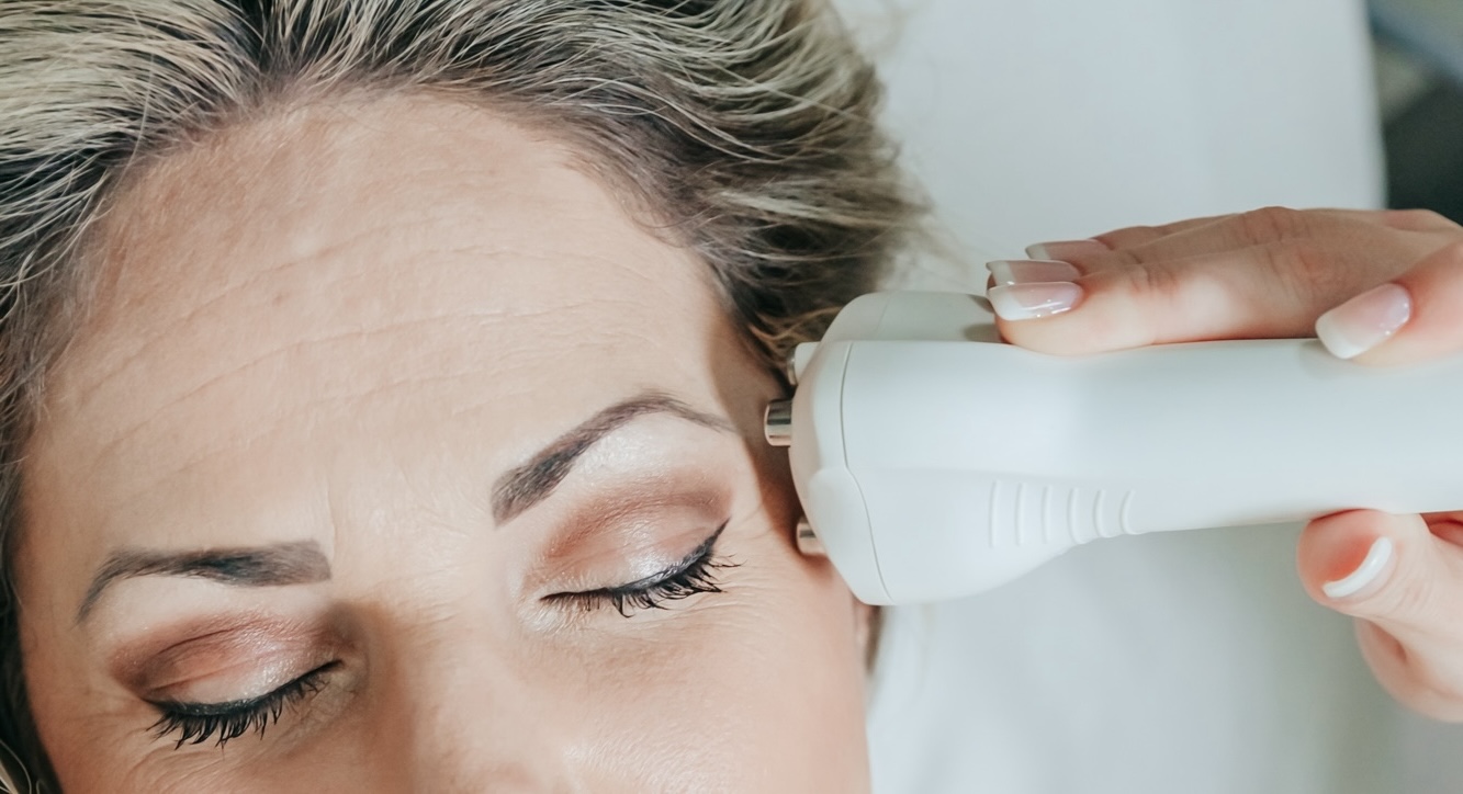 As a blonde woman receives Venus Viva and Venus Legacy facial treatment in St. Charles, IL, a provider's hand presses the device to the patient's temple to help correct age spots, wrinkles, and more.